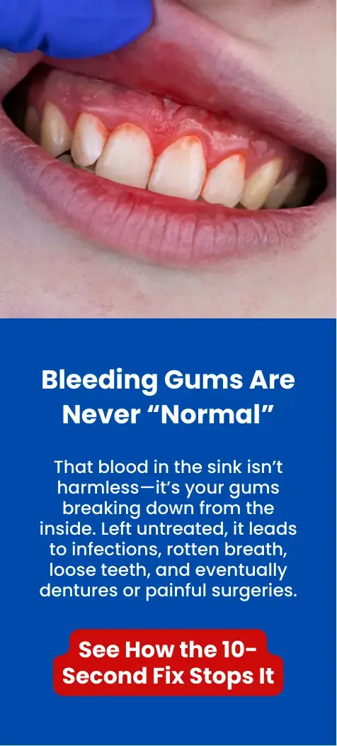 Bleeding gums close up