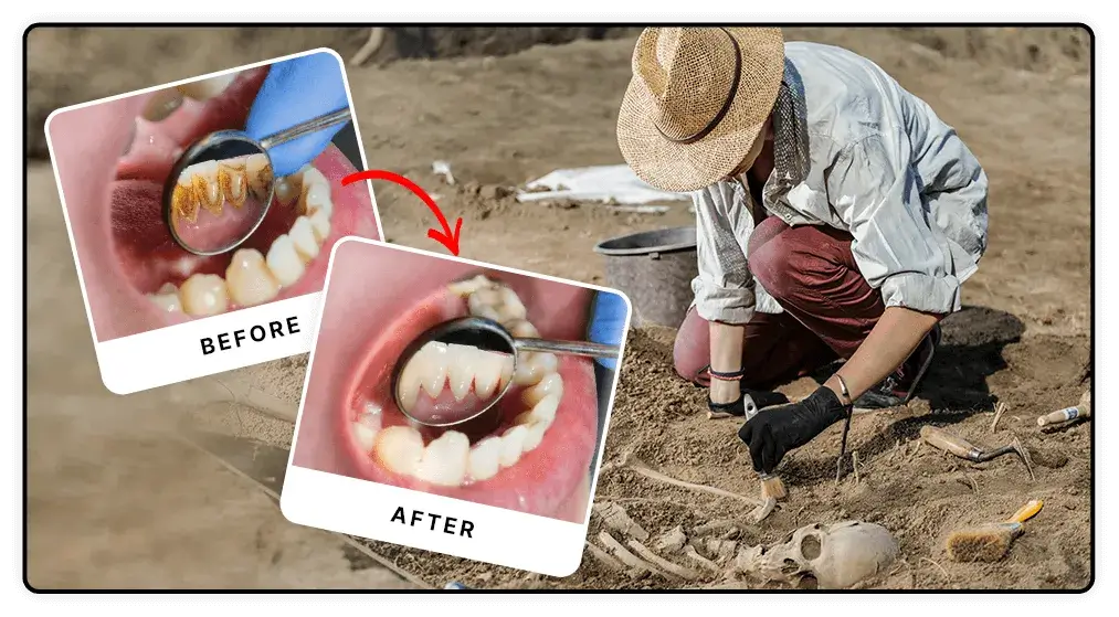 Inflamed gums and plaque on teeth